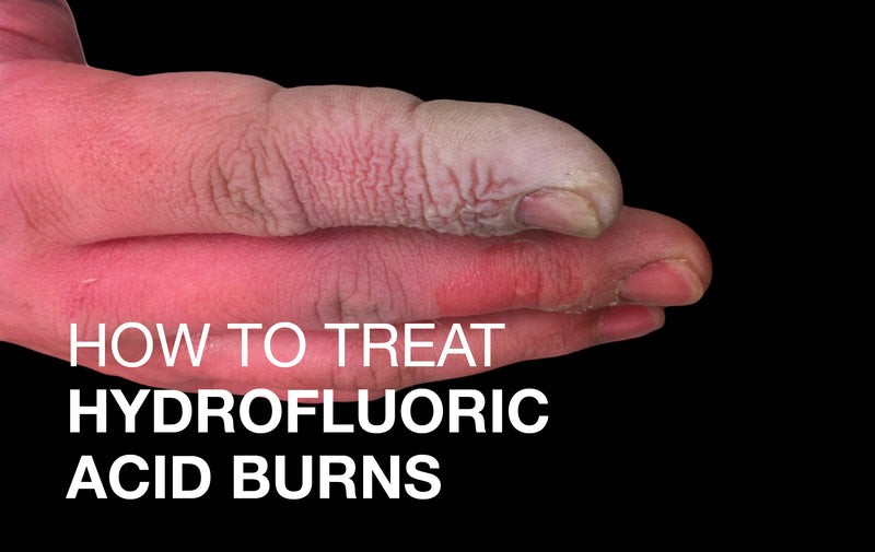 How to treat Hydrofluoric Acid Burns